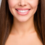 Are Veneers Permanent? Find Out!