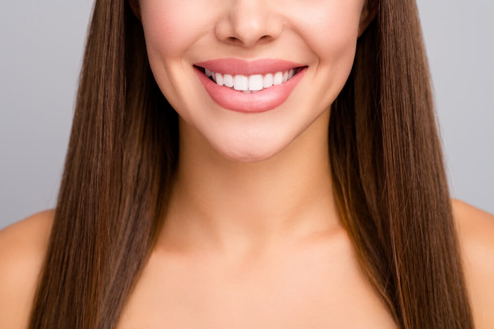 Are Veneers Permanent? Find Out!