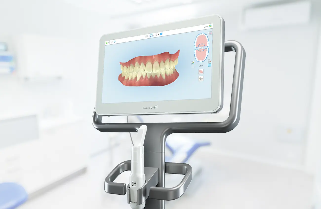 Intraoral Scanner = Mess-Free Treatment
