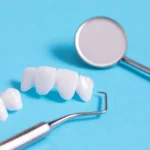 What Do Teeth Look Like Under Veneers?