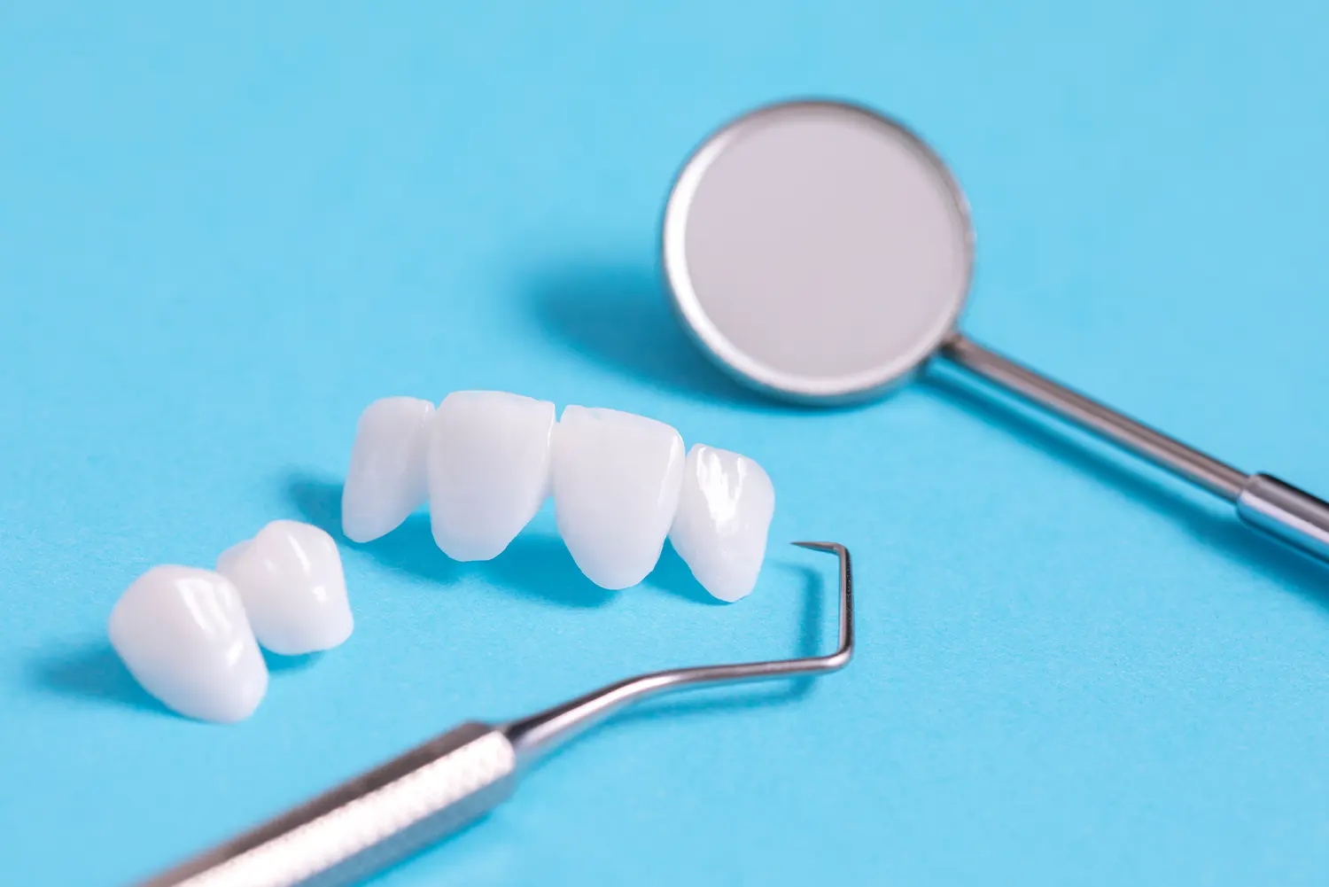 What Do Teeth Look Like Under Veneers?