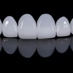 Veneers vs. Crowns: Addressing Both Aesthetic and Functional Concerns