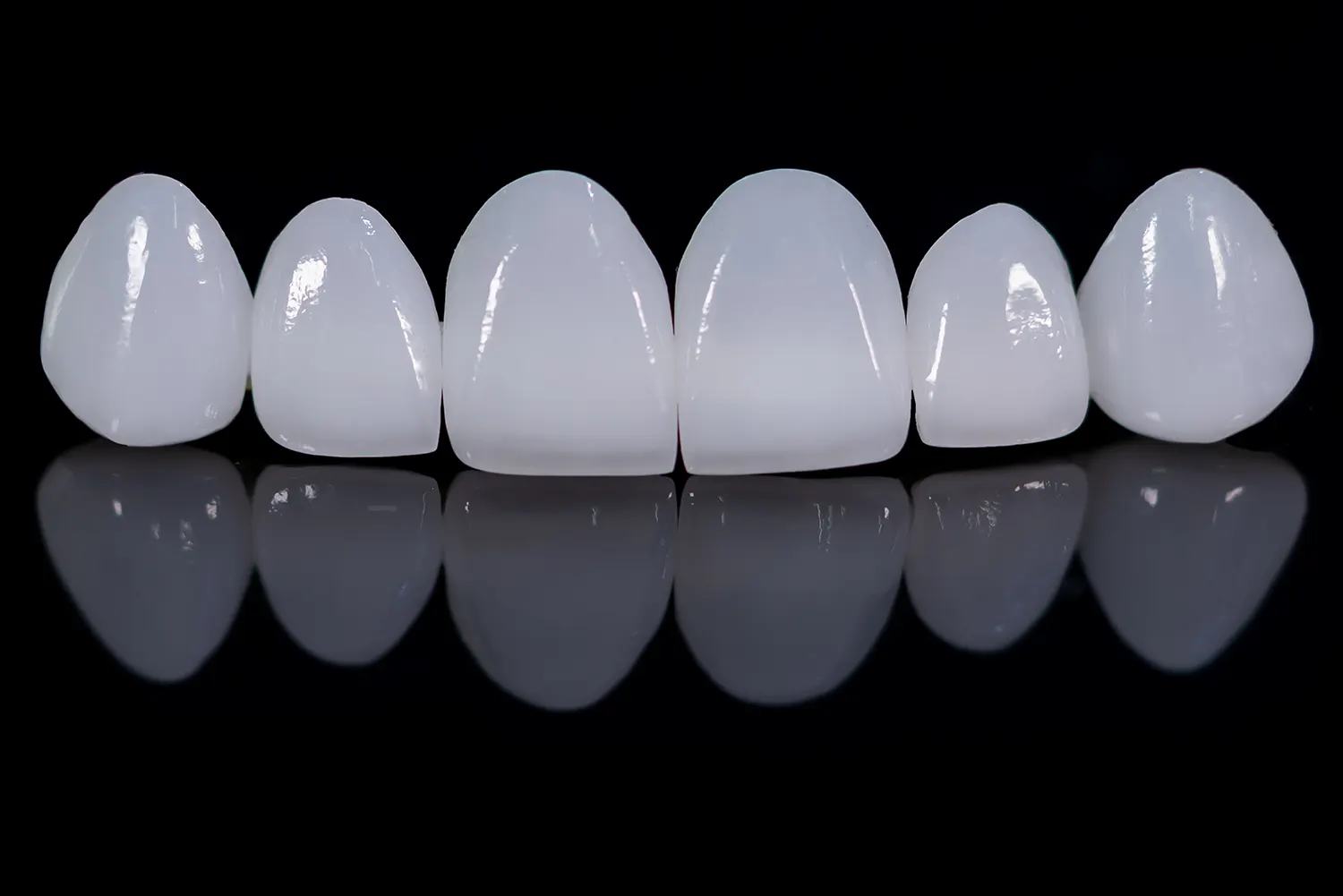 Veneers vs. Crowns: Addressing Both Aesthetic and Functional Concerns